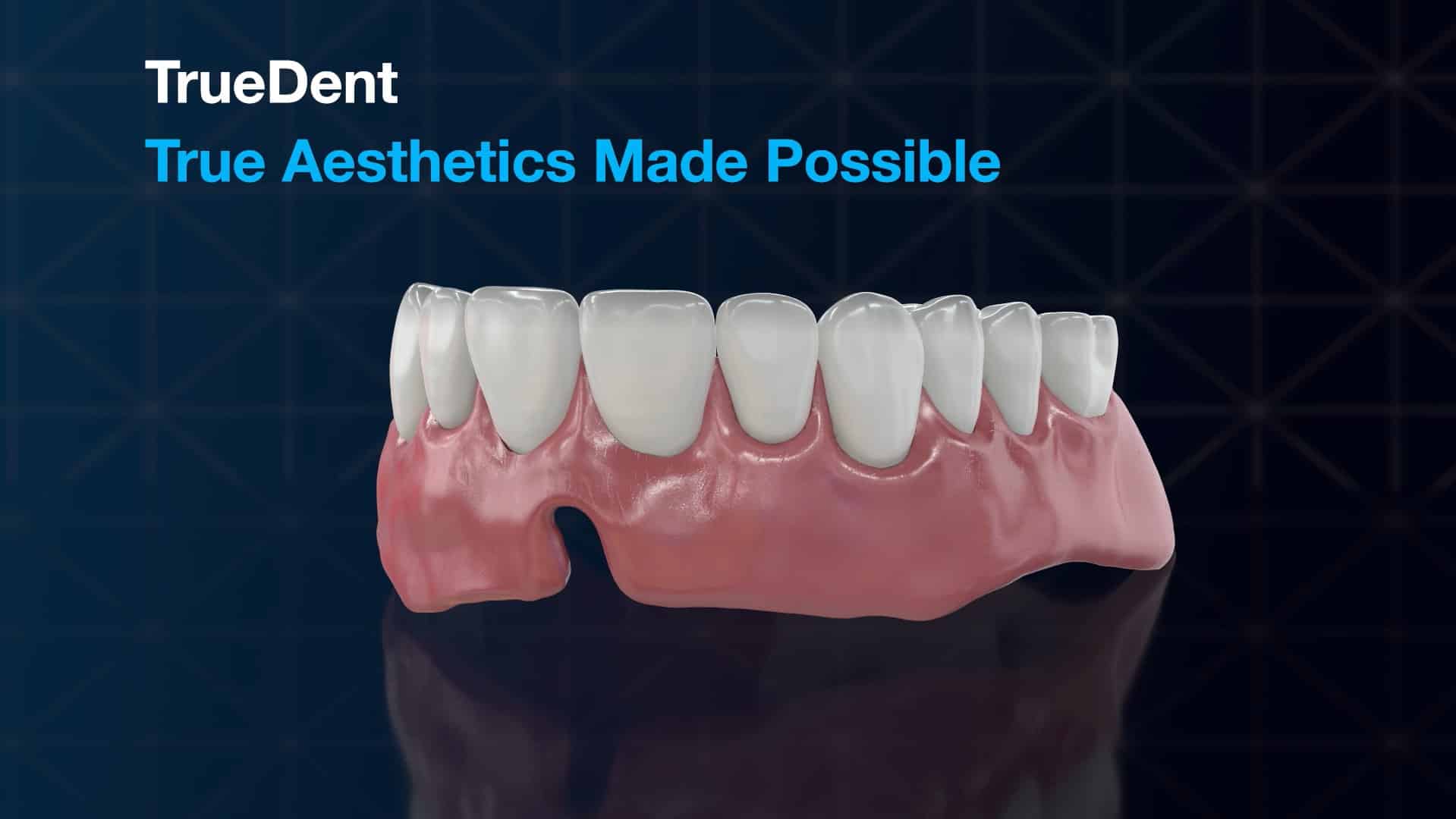 Full-color 3D-printed denture showcasing realistic gum and tooth details
